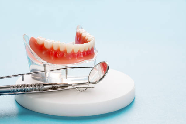 Dental Inlays and Onlays in Connersville, IN